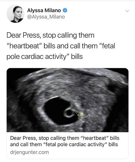 fetal pole cardiac activity.jpg